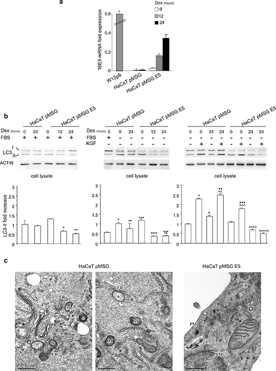 Impairment of autophagy in cells stably expressing 16E5.