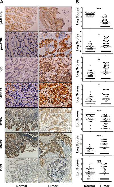 Expression profiles of pAMPK&#x03B1;, p-mTOR, pS6, p4E-BP1, PTEN, MMP7, and DCN in human gastric cancers and adjacent normal mucosa specimens.