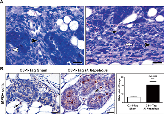 H. hepaticus infection up-regulates MIN-associated neutrophils.