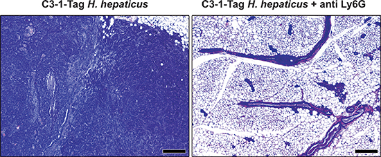 The depletion of neutrophils with anti-Ly-6G antibody blocks effect of H. hepaticus-promoted C3-1-TAg mouse mammary carcinogenesis.