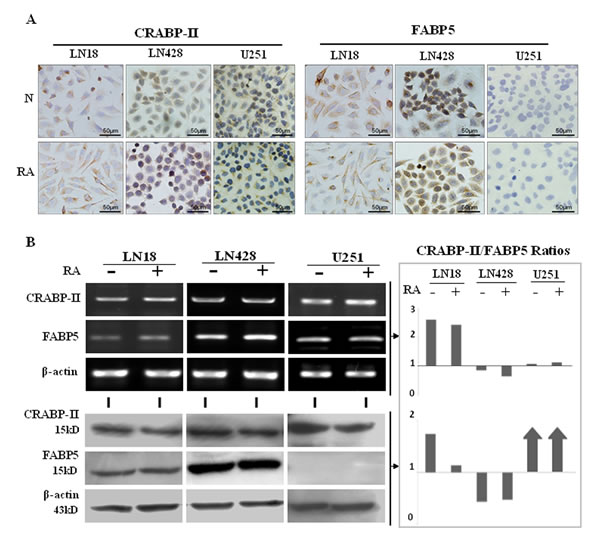 CRABP-II and FABP5 expression patterns in LN18, LN428 and U251 cells with and without RA treatment.