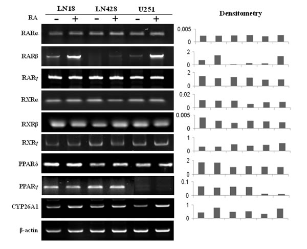RT-PCR profiling of the expression of RARs, RXRs, PPAR&#x3b4;, PPAR&#x3b3; and CYP26A1 in LN18, LN428 and U251 cells before and after RA treatment.