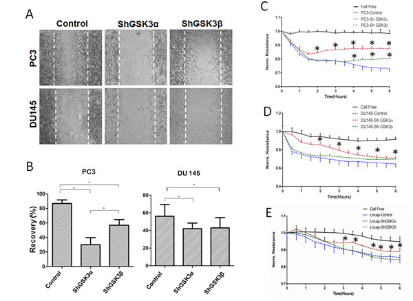 Reduced GSK3&#x3b1; or GSK3&#x3b2; expression leads to inhibition of prostate cancer cell motility and microinvasion