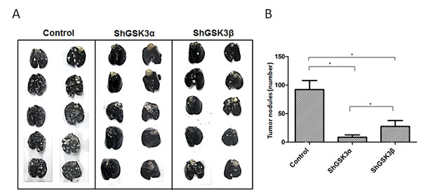 ShRNA-mediated silencing of both GSK3&#x3b1; and GSK3&#x3b2; gene expression inhibited prostate cancer colonization to lungs.