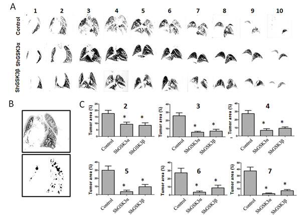 GSK3&#x3b1; gene silencing has improved therapeutic benefits as compared to GSK3&#x3b2; in inhibiting prostate cancer colonization to lungs.