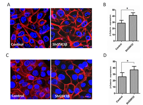 GSK3&#x3b2; gene silencing results in increased expression and membrane localization of &#x3b2;-catenin.