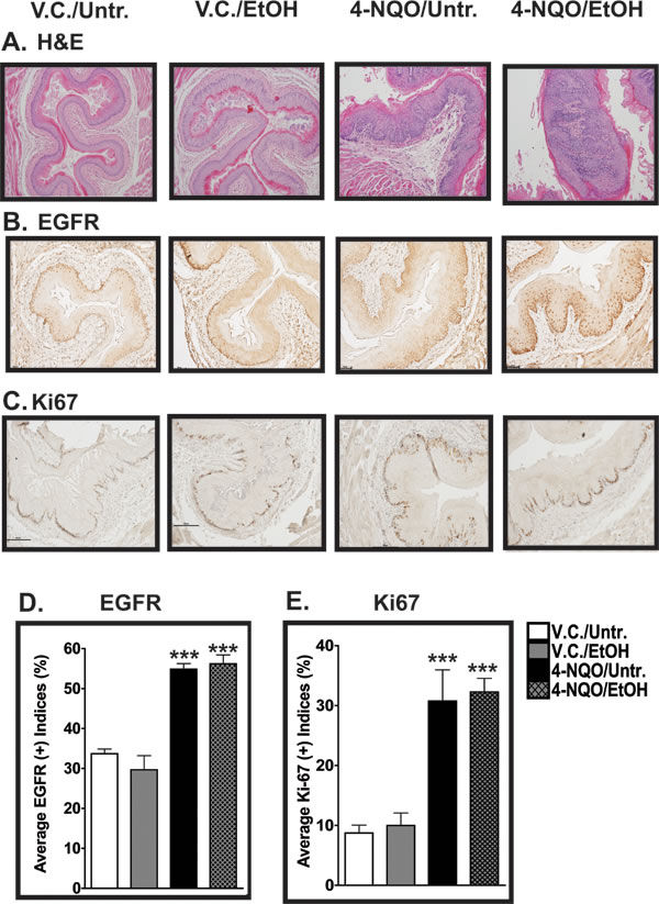 Histopathological and cell proliferation analyses of esophagi of mice treated with 4-NQO and 4-NQO followed by ethanol.