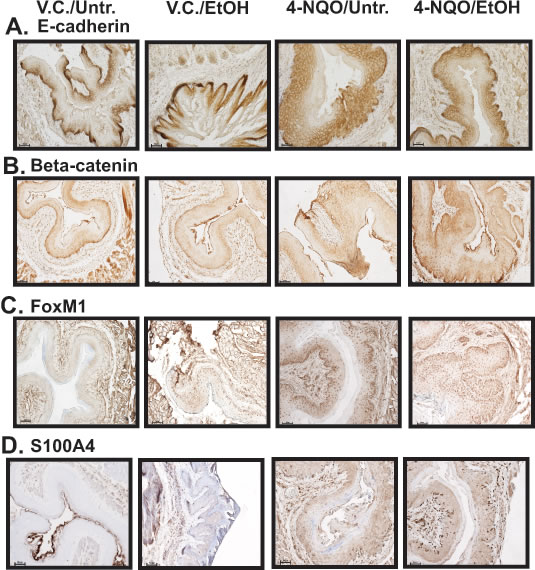 The esophagi of 4-NQO/Untr and 4-NQO/EtOH treated mice display changes in the location of E-cadherin protein and increases in canonical Wnt signaling.