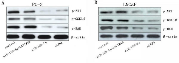 Restoration of miR-188-5p inhibits the PI3K/AKT signaling pathway via the suppression of LAPTM4B.