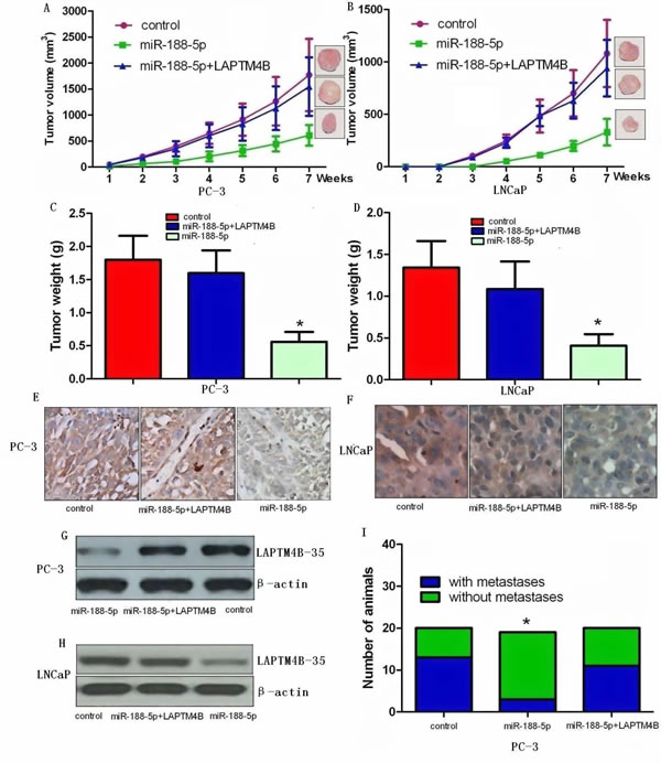 Ectopic expression of miR-188-5p inhibits tumour growth and metastasis via targeting LAPTM4B