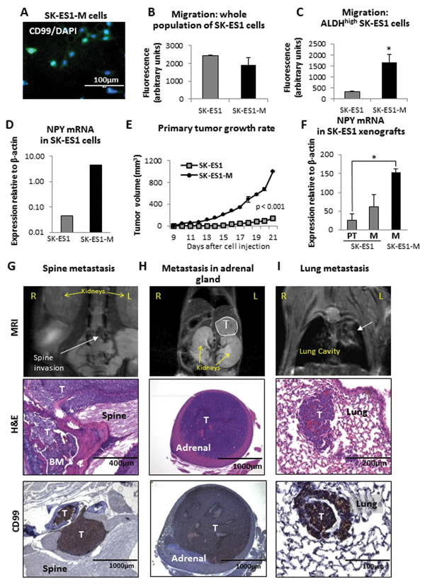 Cells derived from SK-ES1 metastases, SK-ES1-M, exhibit increased motility in the cancer stem cell fraction, enhanced growth