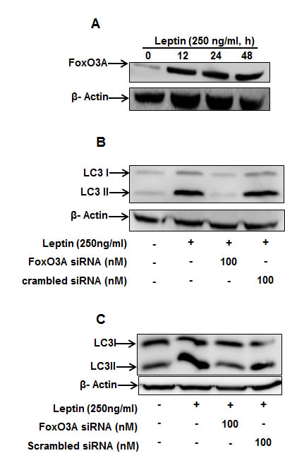 Role of FoxO3A signaling in activation of autophagic process by leptin.