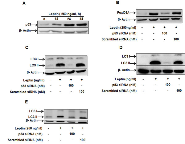 Role of p53 in the modulation of LC3 II protein expression by leptin.
