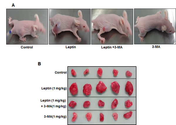 Role of leptin-induced autophagy in tumor growth in xenograft model.