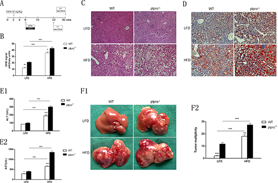 PTPRO deletion in hepatocytes exacerbates steatosis and promotes tumorigenesis.