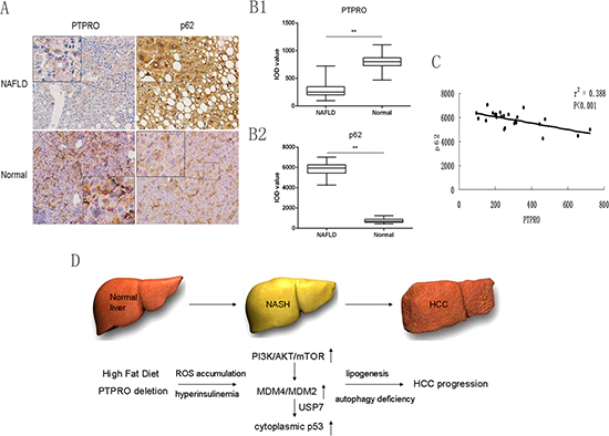 Low expression of PTPRO in hepatocytes may contribute to the inhibition of autophagy and progression of NAFLD in human samples.