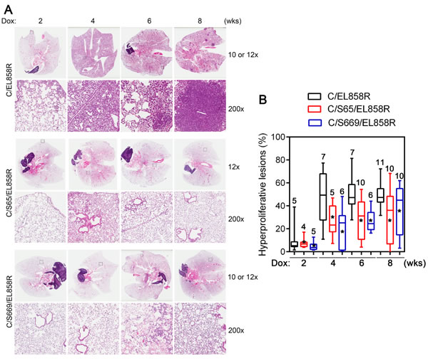 Lung hyperproliferative lesions in transgenic mice.