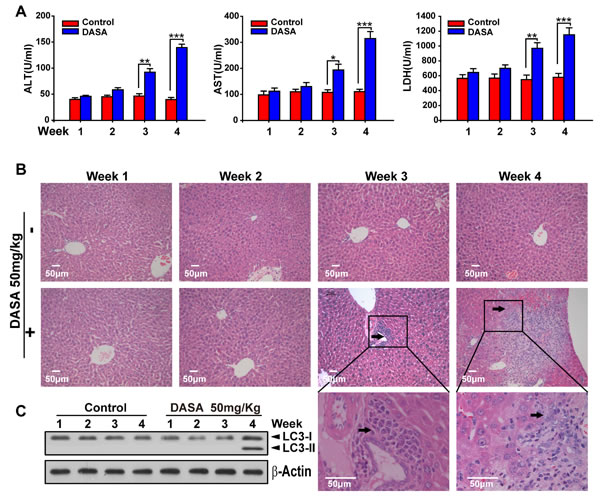 Dasatinib induced the liver injury and autophagy sequence.