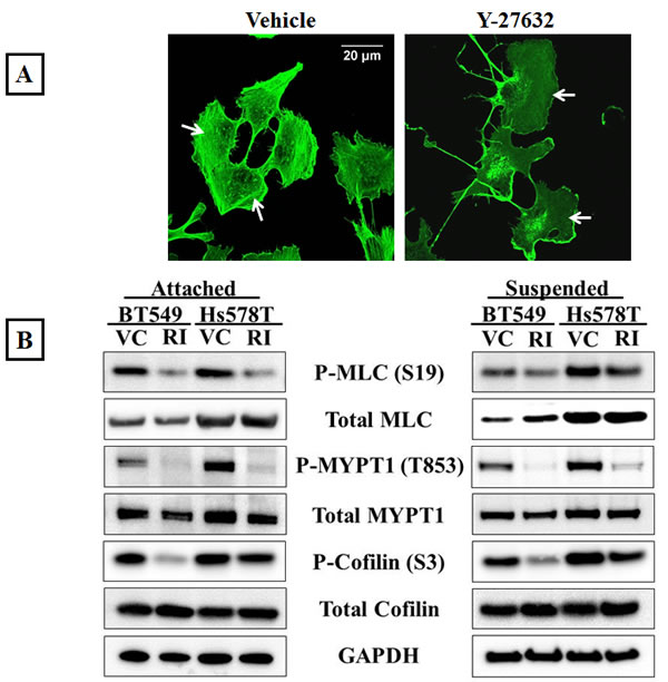 Inhibition of ROCK activity decreases actomyosin interaction.