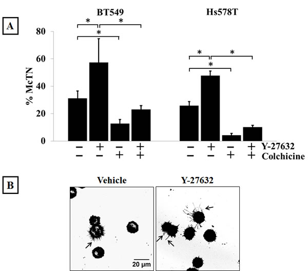 Modulation of Rho/ROCK activity regulates McTN formation.