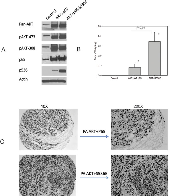 p65 Ser536 phosphorylation promotes tumor growth