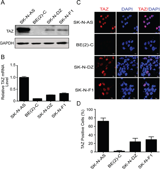 TAZ is commonly expressed in neuroblastomas.