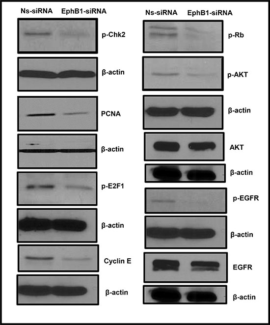 EphB1 knockdown modulates the expression of cell cycle, proliferation, cell survival proteins.