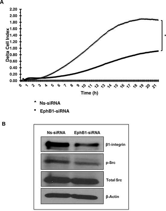Knockdown of EphB1 receptor reduces medulloblastoma cell migration.