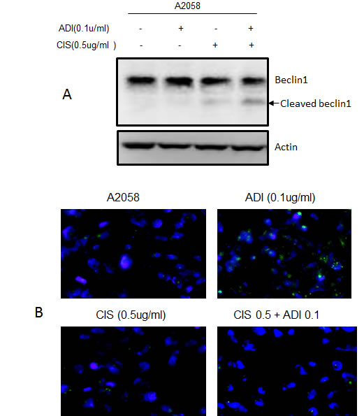 Fig.6: Arginine deprivation leads to autophagy was abrogated by the addition of cisplatin.