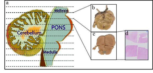 Fig.1: Postmortem processing of brainstem and cerebellum.