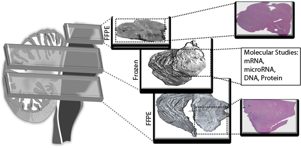 Fig.4: Detailed histological studies of brainstem tissue is enhanced by matched FFPE sections for each frozen specimen.