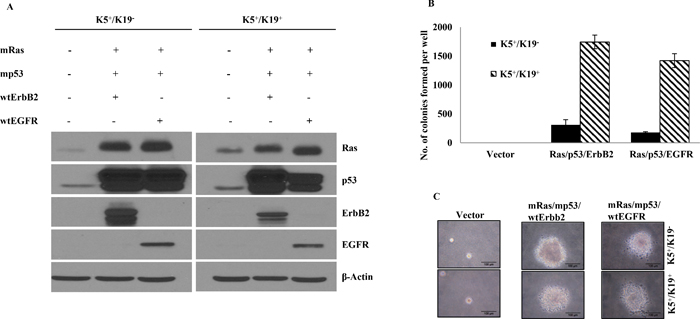 Transformation of K5+/K19&#x2212; or K5+/K19+ cells with different gene combination.