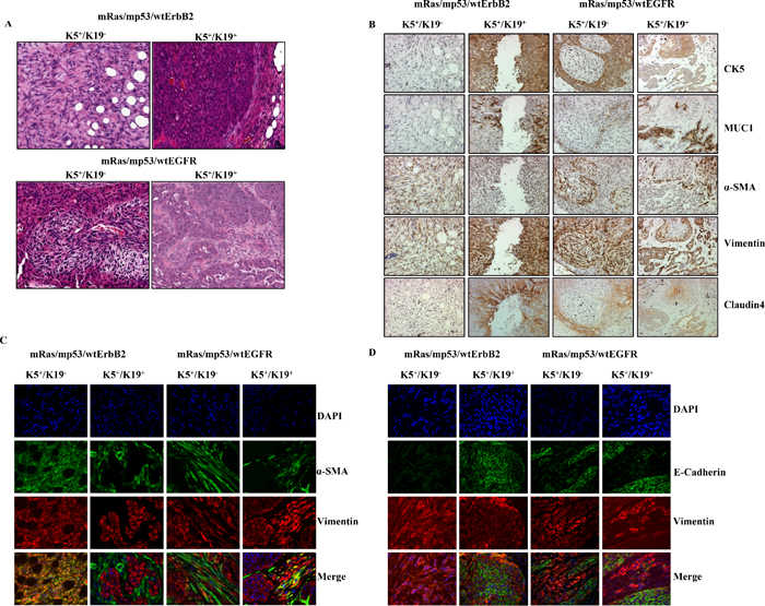 Transformed K5+/K19&#x2212; or K5+/K19+ cells give rise to distinct tumors.