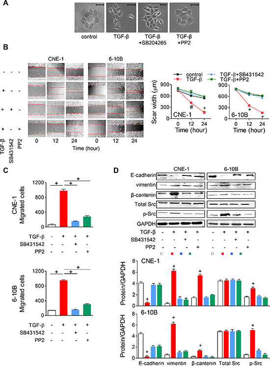 TGF-&#x03B2; promotes EMT via Src activation in NPC cells.