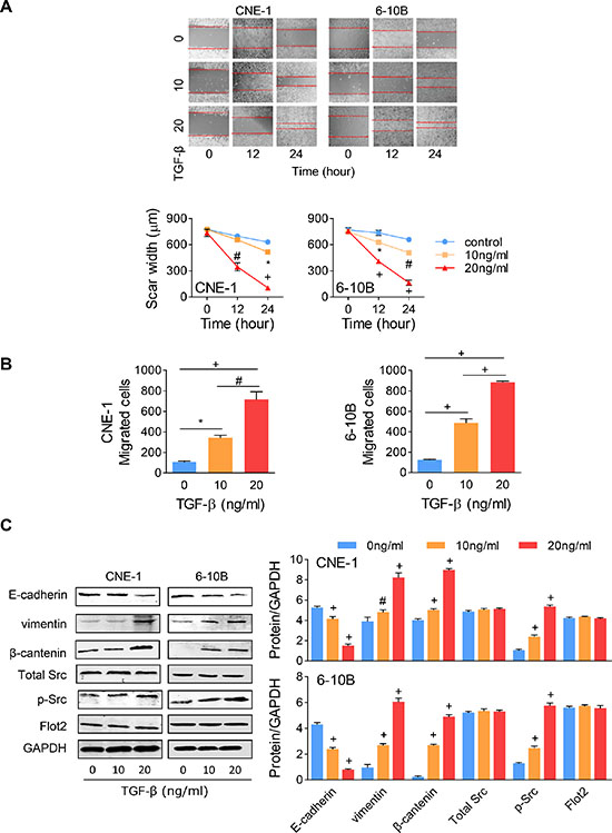 TGF-&#x03B2;-induced EMT has no influence on Flot2 expression.