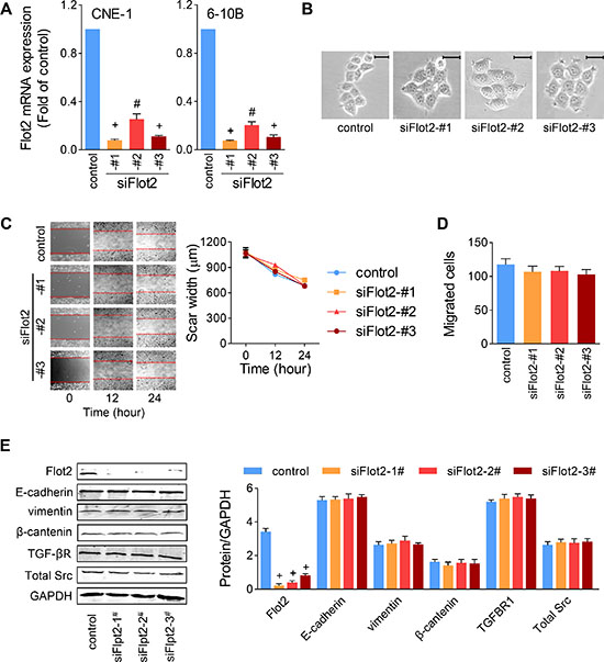Silencing Flot2 alone does not changed NPC cell motility.