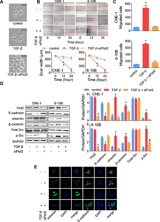 TGF-&#x03B2;-induced EMT was reversed by Flot2 silencing.
