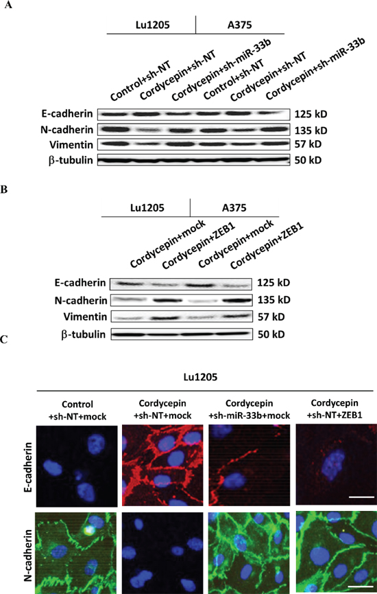 Knockdown of miR-33b promoted epithelial-mesenchymal transitions (EMT) of cordycepin-treated Lu1205 and A375 cells and re-expression of ZEB1 reversed miR-33b-dependent MET phenotype of Lu1205 cells.