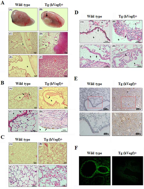 The exterior and histopathologic staining and immunohistochemical (IHC) staining of lung tissues from wild-type and transgenic mice.