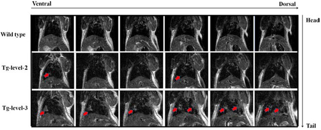 The MRI images of tumors (arrows) in the lung tissues of wild type mice and in two different tumorigenesis levels of transgenic mice (Tg-level-2 and Tg-level-3).