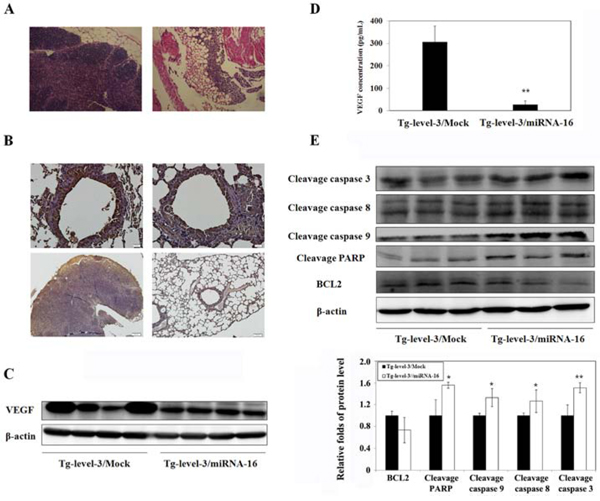 MicroRNA-16 reduces pulmonary tumorigenesis in transgenic mice.