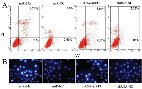 Modulation of miR-34a-SIRT1 axis enhanced MCF-7 cell apoptosis.