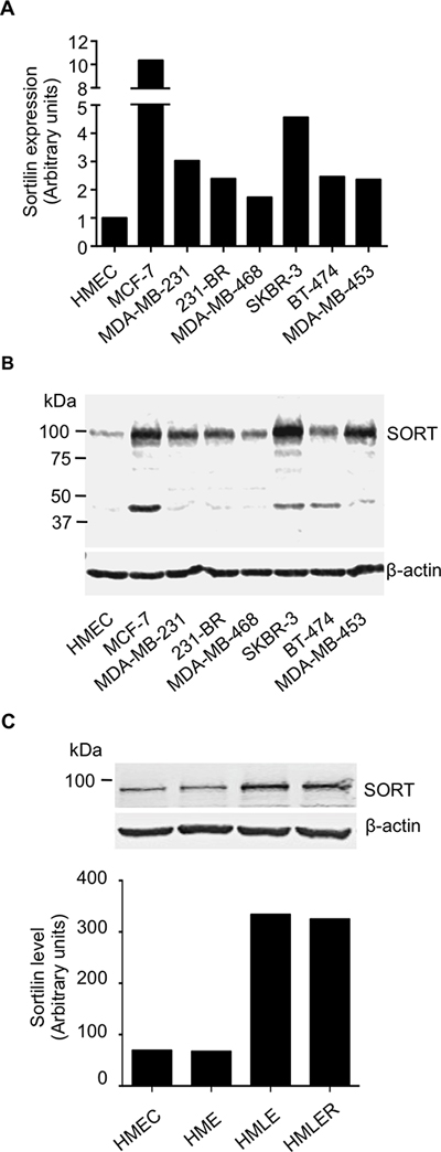 Expression of sortilin in breast cancer cell lines.