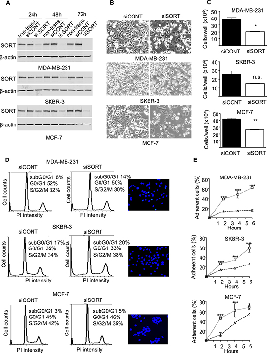 Impact of sortilin knockdown on proliferation, survival and adhesion of breast cancer cells.