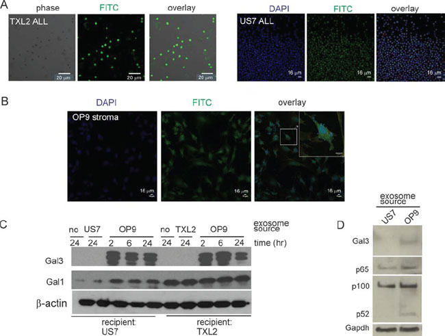 Uptake of OP9 exosome content by ALL cells.