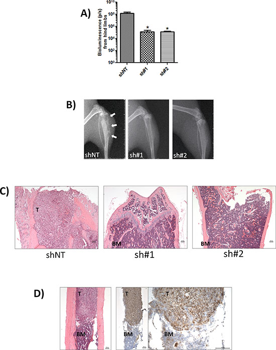 CD44 expression promotes bone metastasis.