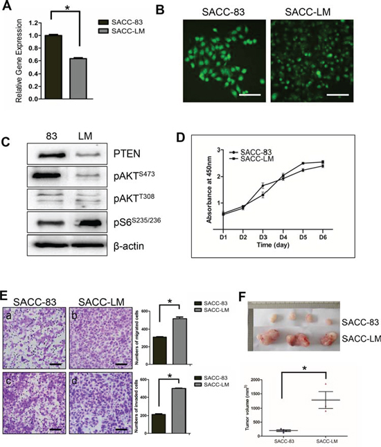 Reduced expression of PTEN in human SACC cell lines correlated with migration, invasion in vitro and tumor size in vivo.