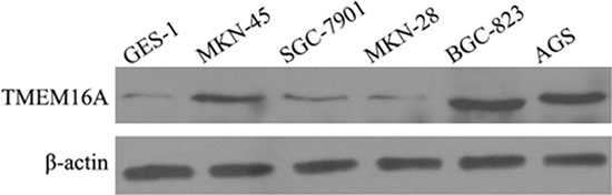The expression of TMEM16A in GC cell lines by western blot analysis.