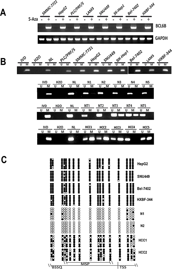 BCL6B expression was silenced by promoter region hypermethylation in HCC.