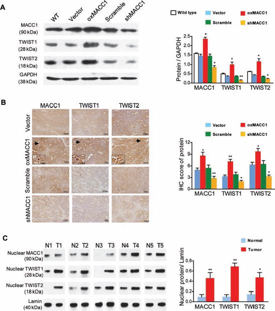 MACC1 upregulates TWIST1 and TWIST2 expression in GC cells and tumor tissues.